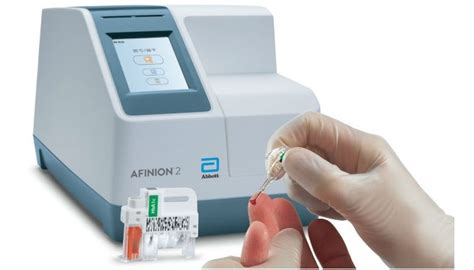 hba1c test machine|abbott afinion hba1c control sheet.